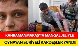 Kahramanmaraş’ta mangal jeliyle oynayan Suriyeli kardeşler yandı!