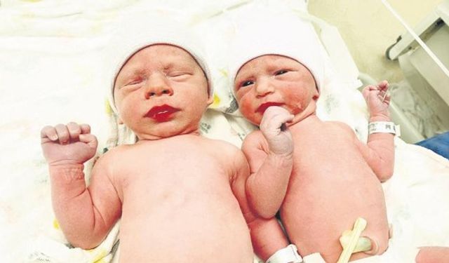 Mucize ikizler! 31 Ekim'de dünyaya geldiler ama 31 yaşındalar
